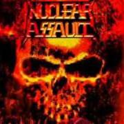 Il testo WHINE AND CHEESE dei NUCLEAR ASSAULT è presente anche nell'album Third world genocide (2005)