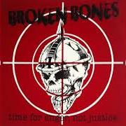 Time for anger, not justice