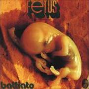 Foetus