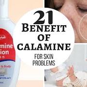 Calamine