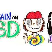 Acid Brains